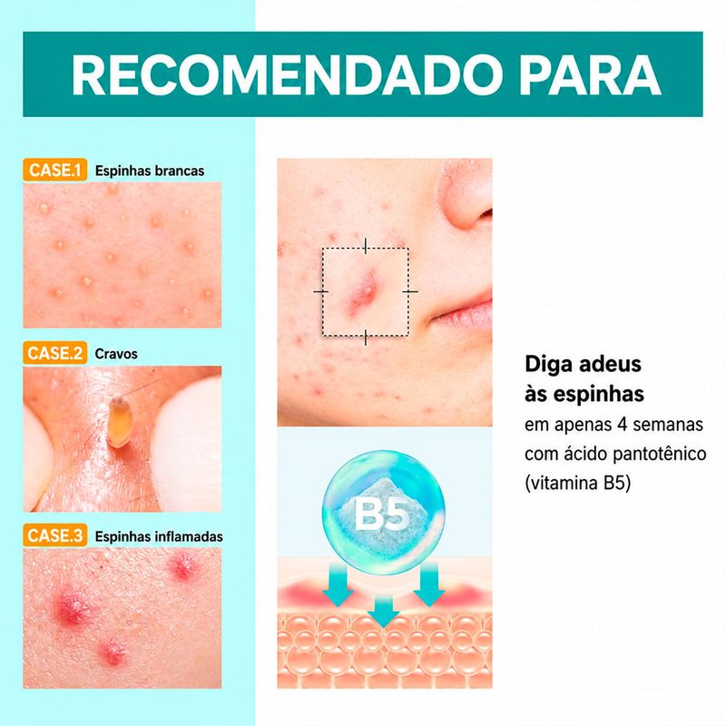 Numbuzin Nº 1 Pantothenic B5 Active Soothing Cream - Creme Facial Calmante 80ml