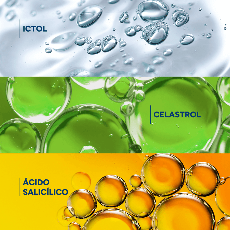 Shampoo Kertyol Pso 125Ml - Ducray 5