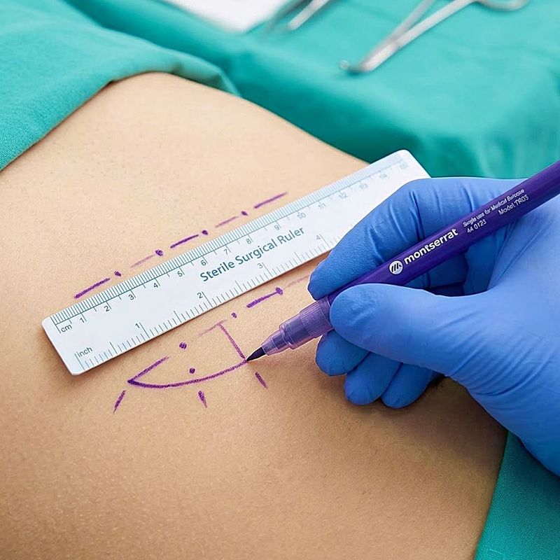 Caneta Cirúrgica Dermografica Ponta Normal Estéril - unidade