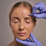 Caneta Cirúrgica Dermografica Ponta Normal Estéril - unidade