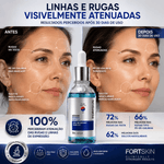 FortSkin GHK-CU 10% Smart Sérum Repair 30ml FortLife